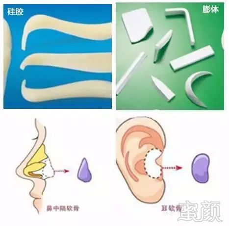 https://img.miyanlife.com/mnt/timg/190614/121G92103-1.jpg