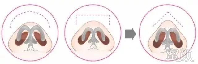 https://img.miyanlife.com/mnt/timg/190614/121H1O62-4.jpg