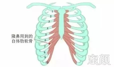 https://img.miyanlife.com/mnt/timg/190614/121H24537-7.jpg
