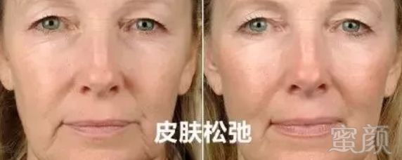 https://img.miyanlife.com/mnt/timg/190615/114R43V8-4.jpg