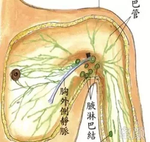 案例图片