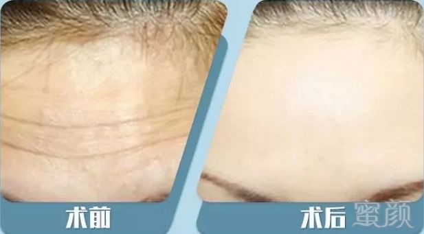 https://img.miyanlife.com/mnt/timg/190615/141S13117-4.jpg