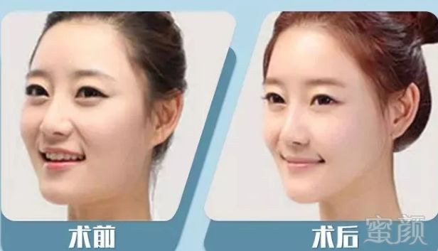 https://img.miyanlife.com/mnt/timg/190615/141S140L-5.jpg