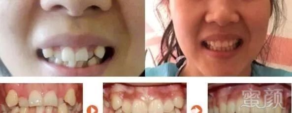https://img.miyanlife.com/mnt/timg/190615/1420492961-1.jpg