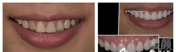 https://img.miyanlife.com/mnt/timg/190615/1420501O7-2.jpg