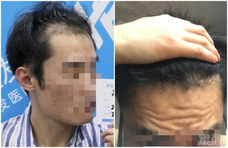 https://img.miyanlife.com/mnt/timg/190615/143T94458-4.jpg