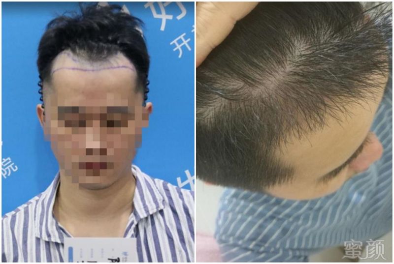 https://img.miyanlife.com/mnt/timg/190615/143U11122-5.jpg