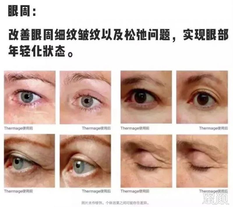 https://img.miyanlife.com/mnt/timg/190616/1004353649-12.jpg