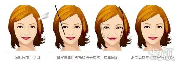 https://img.miyanlife.com/mnt/timg/190616/10043C1X-15.jpg