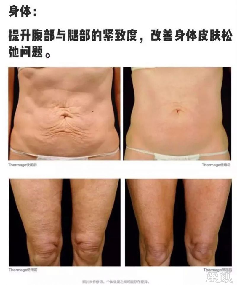 https://img.miyanlife.com/mnt/timg/190616/10043Ca2-13.jpg