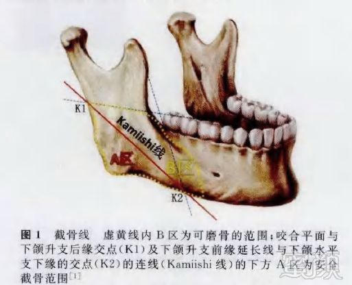 案例图片