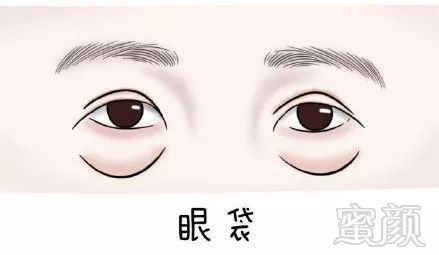 https://img.miyanlife.com/mnt/timg/190616/1111455D3-0.jpg