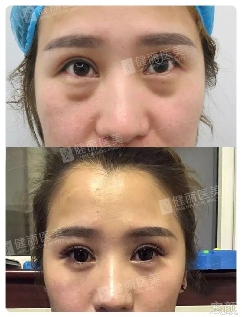 https://img.miyanlife.com/mnt/timg/190616/1112013523-7.jpg