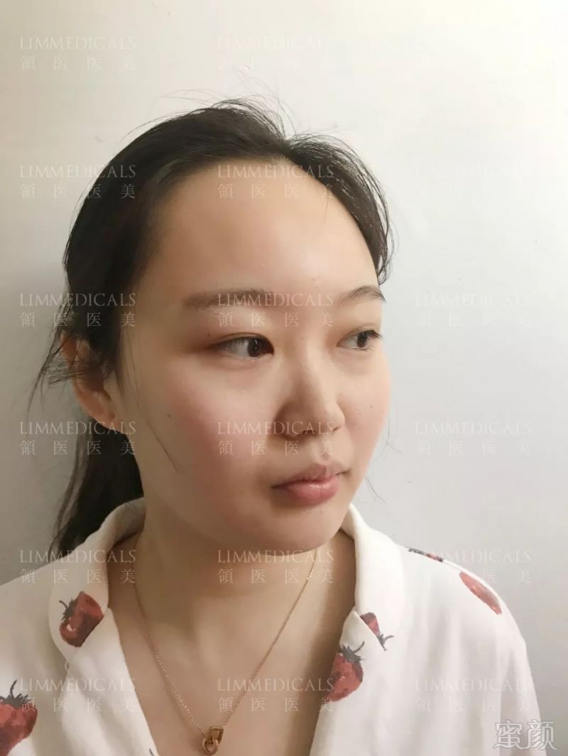 https://img.miyanlife.com/mnt/timg/190618/11505T262-5.jpg