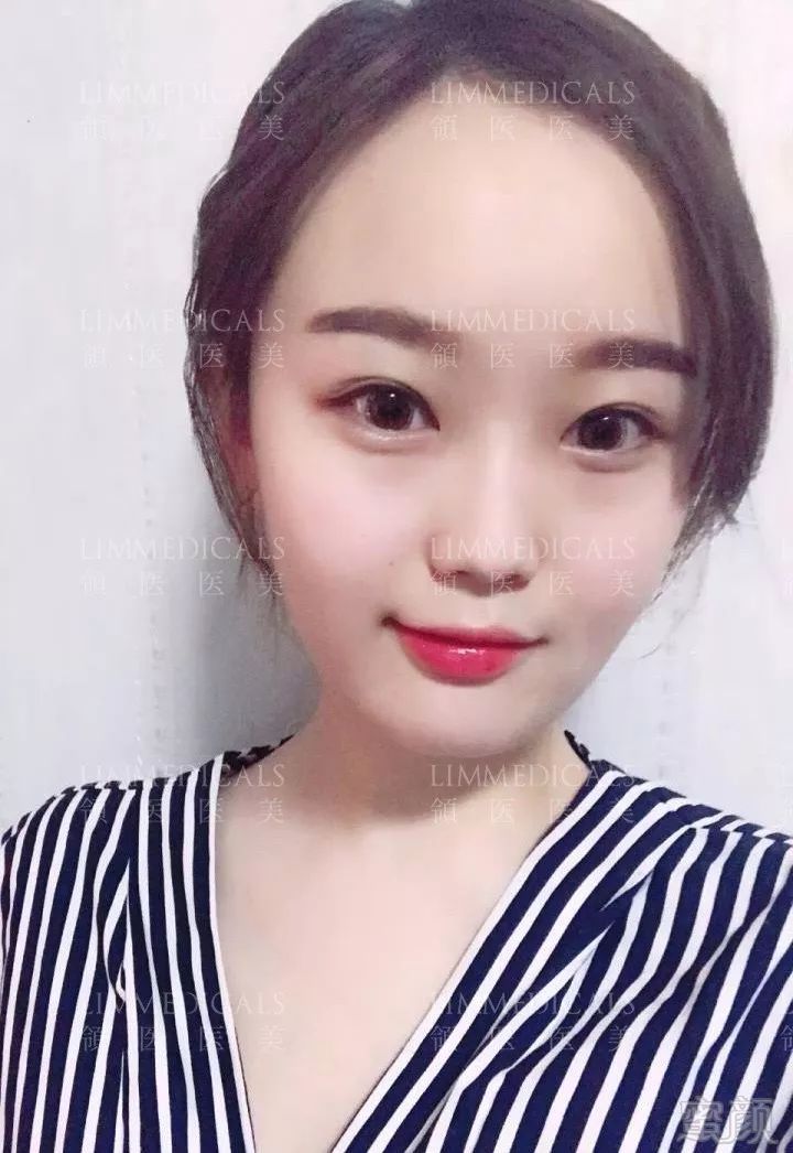 https://img.miyanlife.com/mnt/timg/190618/1151013Q7-10.jpg