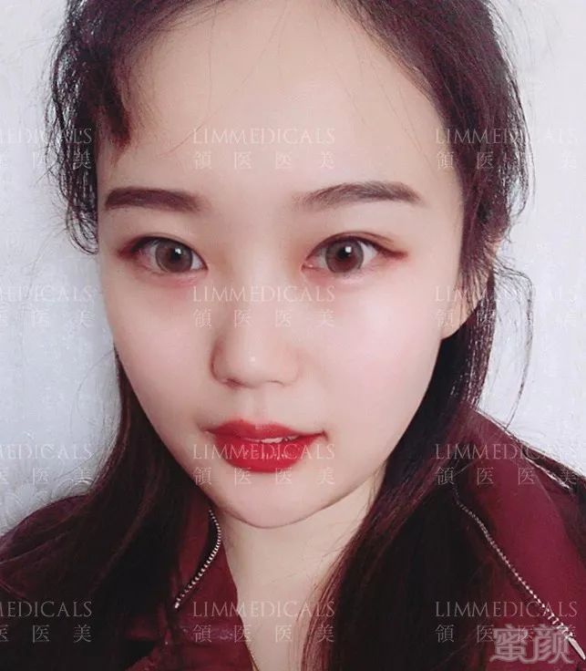 https://img.miyanlife.com/mnt/timg/190618/1151022X4-12.jpg