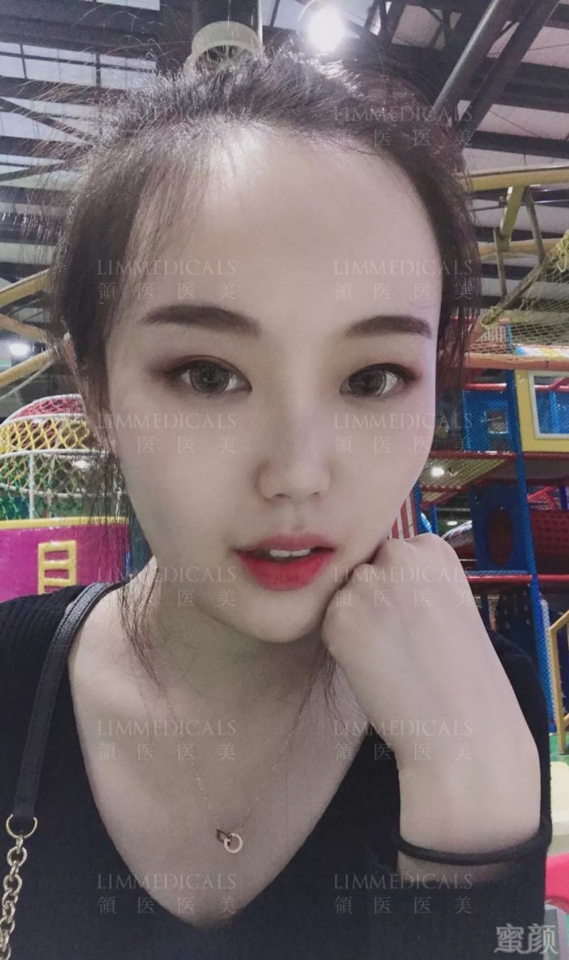 https://img.miyanlife.com/mnt/timg/190618/115103H50-14.jpg