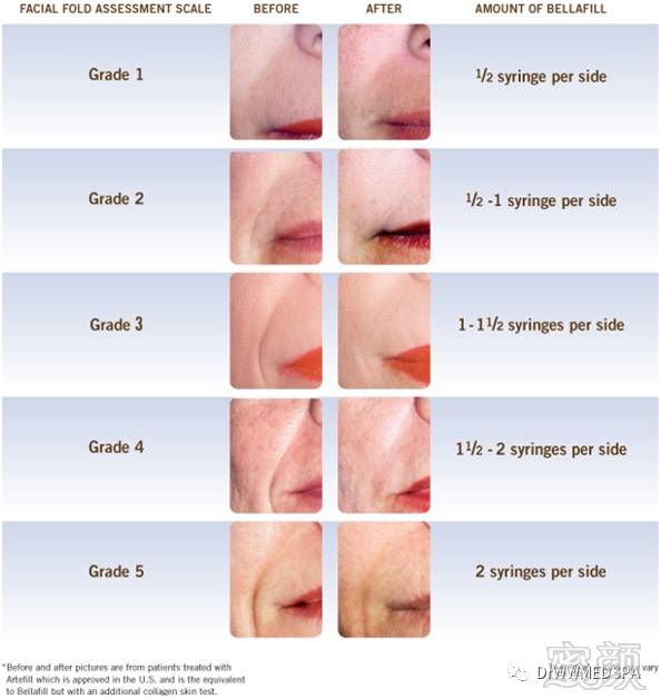 https://img.miyanlife.com/mnt/timg/190618/120425D38-5.jpg