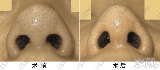 https://img.miyanlife.com/mnt/timg/190619/11191L357-7.jpg 案例图片