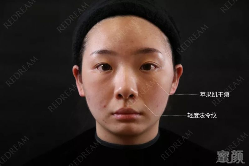 https://img.miyanlife.com/mnt/timg/190620/1116432940-1.jpg