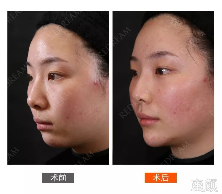 https://img.miyanlife.com/mnt/timg/190620/11164520N-9.jpg