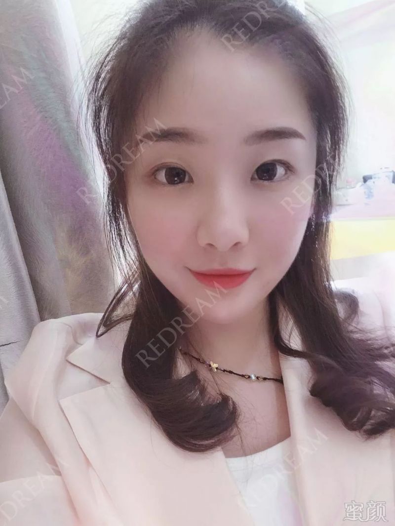 https://img.miyanlife.com/mnt/timg/190620/111645L03-10.jpg