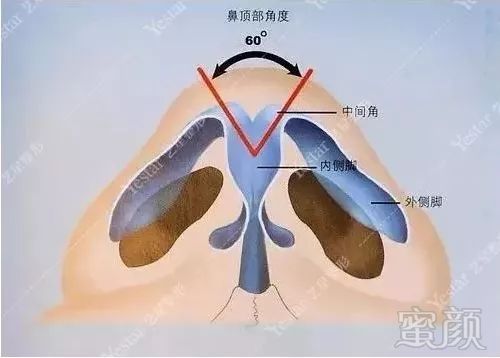 案例图片