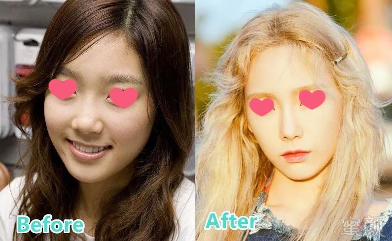 大揭秘丨为什么整形脸崩的大部分是韩国人 热备资讯