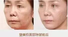 https://img.miyanlife.com/mnt/timg/190621/1125391Y8-5.jpg