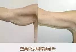 https://img.miyanlife.com/mnt/timg/190621/1125394O0-6.jpg