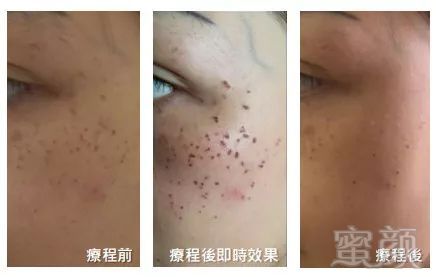 https://img.miyanlife.com/mnt/timg/190621/11433K2U-10.jpg