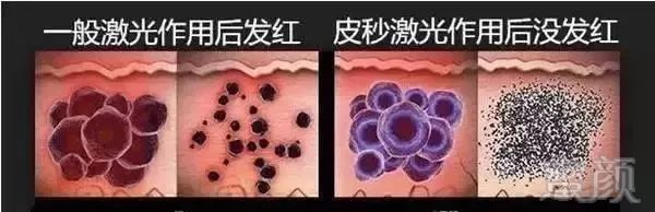 https://img.miyanlife.com/mnt/timg/190621/11433LU2-7.jpg