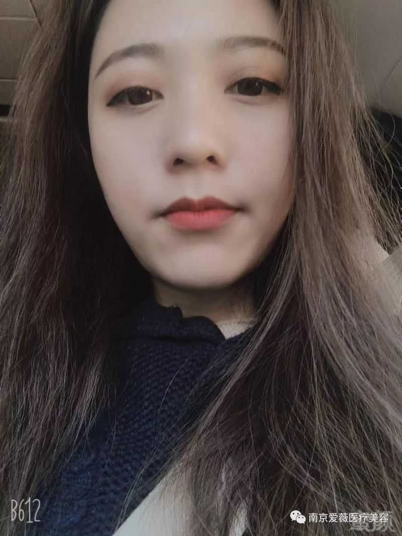 https://img.miyanlife.com/mnt/timg/190622/1113195558-5.jpg