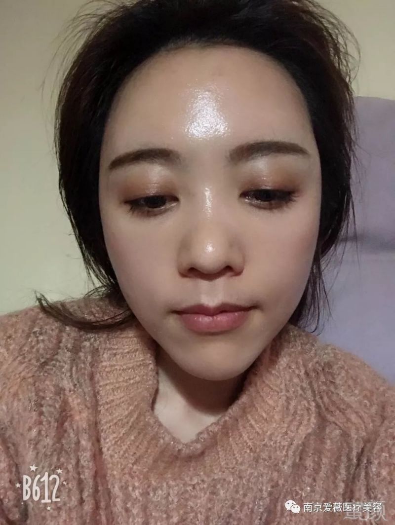 https://img.miyanlife.com/mnt/timg/190622/11131K436-2.jpg