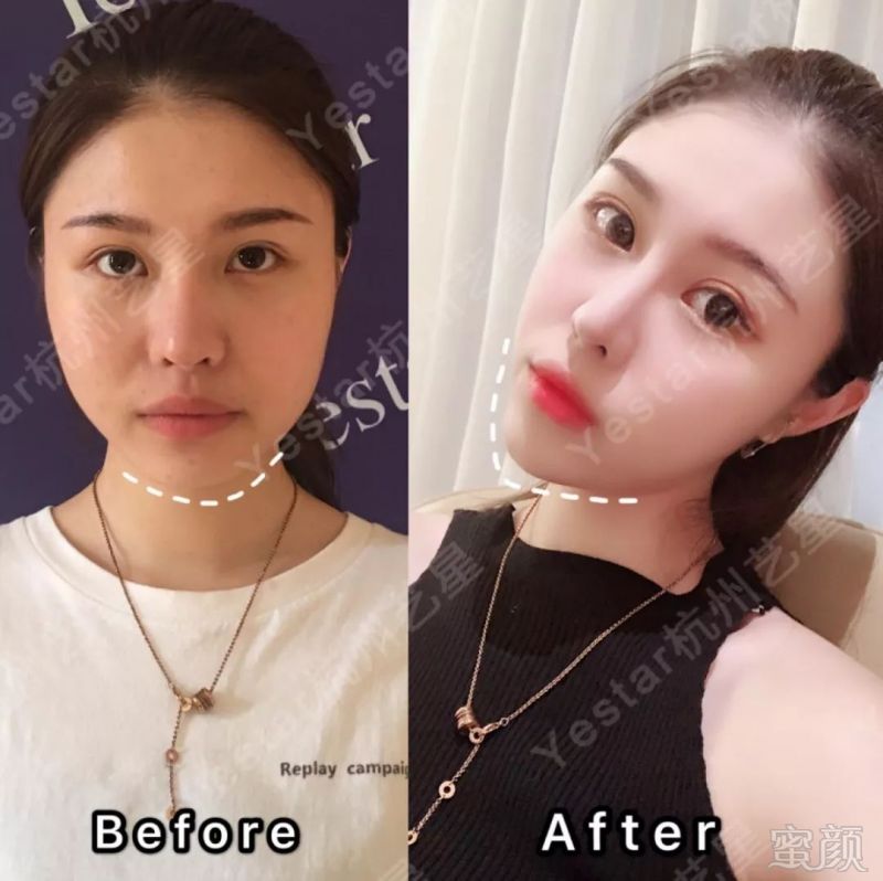 https://img.miyanlife.com/mnt/timg/190623/0955593061-1.jpg
