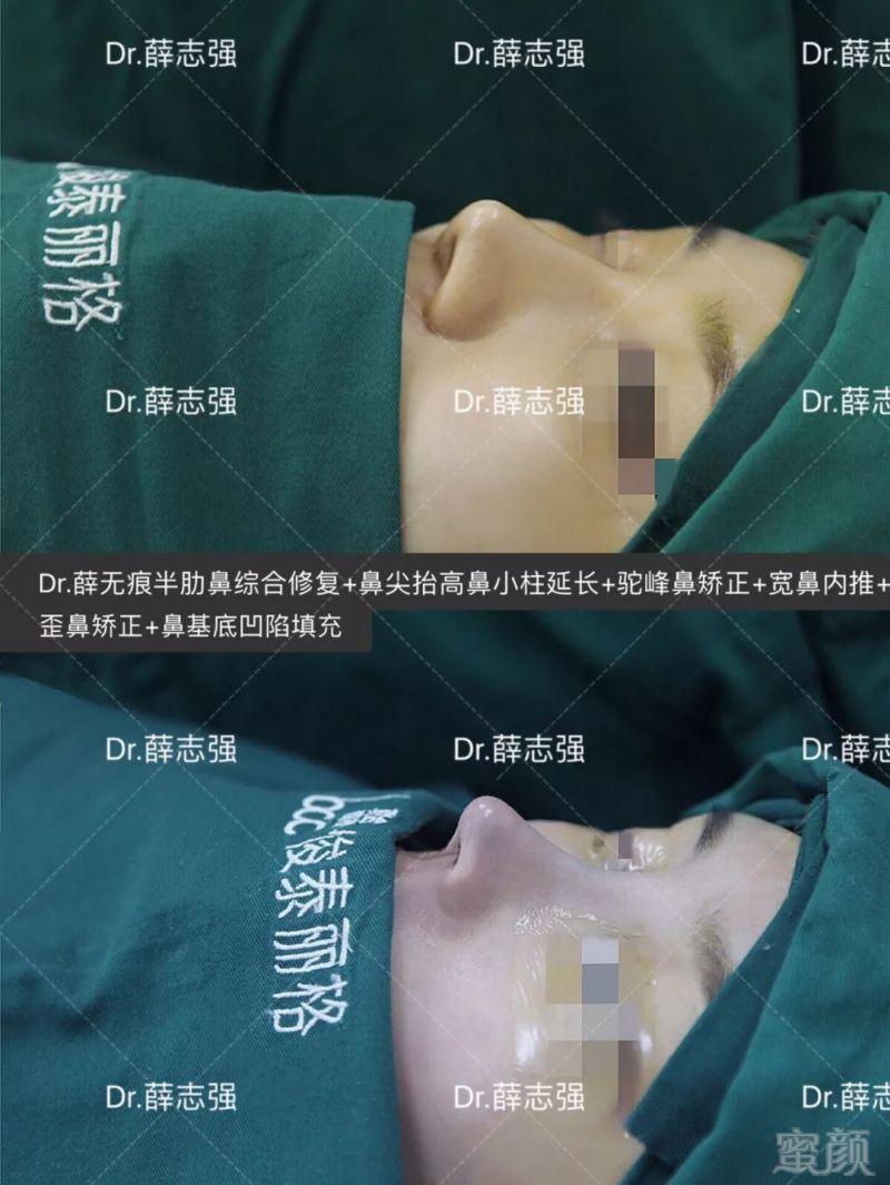 https://img.miyanlife.com/mnt/timg/190624/1151333Y2-6.jpg