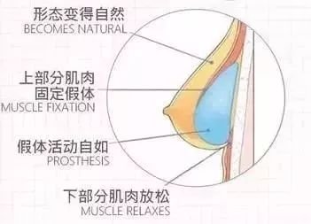 案例图片