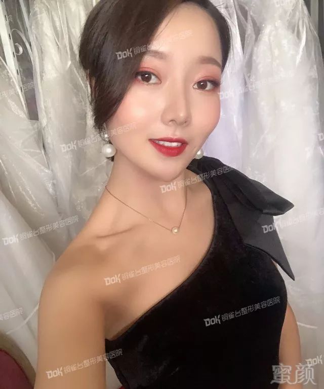 https://img.miyanlife.com/mnt/timg/190625/1143321436-15.jpg