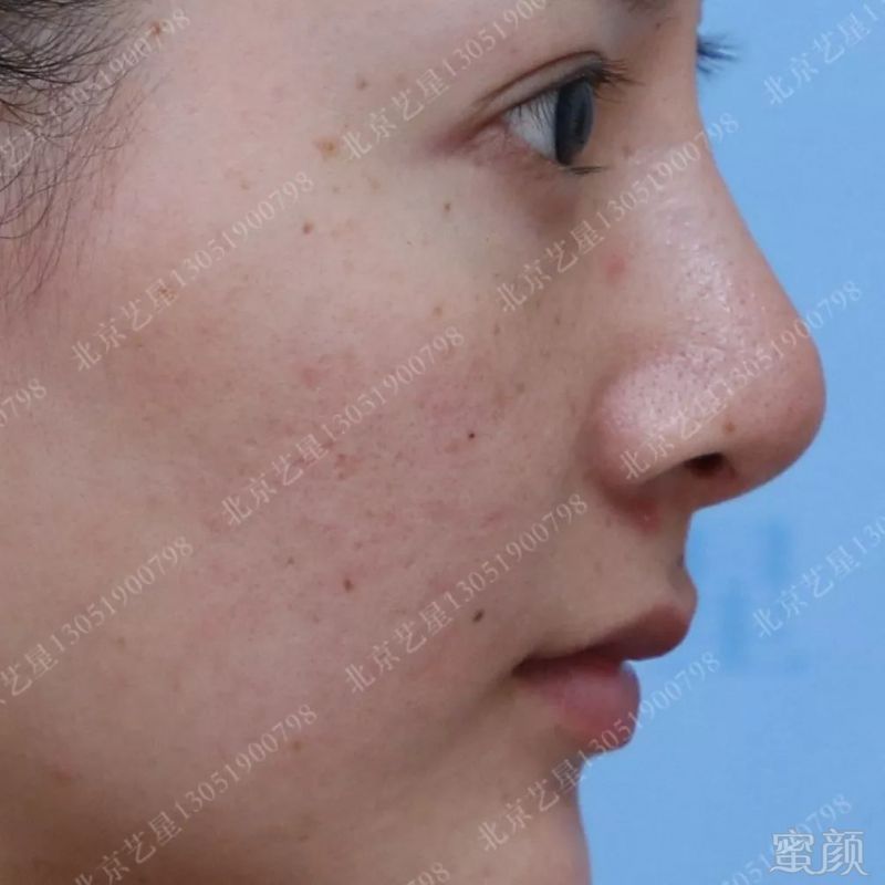 https://img.miyanlife.com/mnt/timg/190625/115H53517-8.jpg