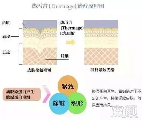 https://img.miyanlife.com/mnt/timg/190625/121P0M12-3.jpg