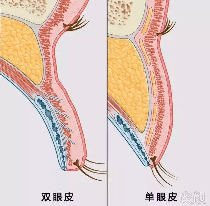 案例图片