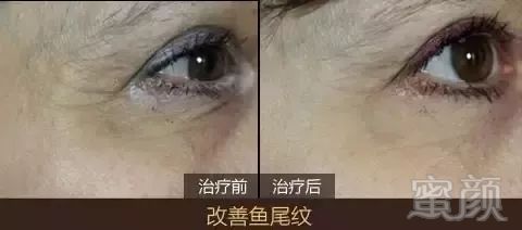 https://img.miyanlife.com/mnt/timg/190626/111Z06151-6.jpg