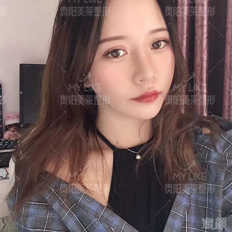 https://img.miyanlife.com/mnt/timg/190626/113K22150-1.jpg