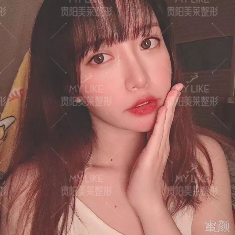 https://img.miyanlife.com/mnt/timg/190626/113K23921-2.jpg