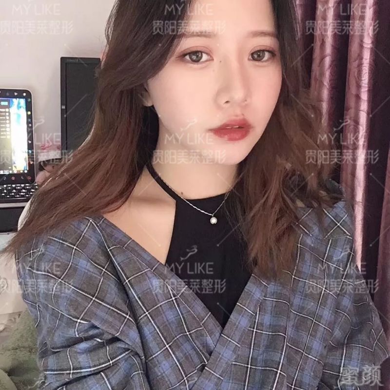 https://img.miyanlife.com/mnt/timg/190626/113K33V2-5.jpg