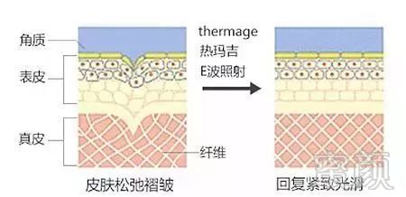 https://img.miyanlife.com/mnt/timg/190626/115255IT-2.jpg