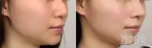 https://img.miyanlife.com/mnt/timg/190627/11341340X-3.jpg