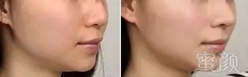 https://img.miyanlife.com/mnt/timg/190627/113413J49-5.jpg