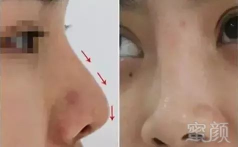 https://img.miyanlife.com/mnt/timg/190627/11353943Z-3.jpg
