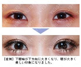 https://img.miyanlife.com/mnt/timg/190627/12114935W-4.jpg